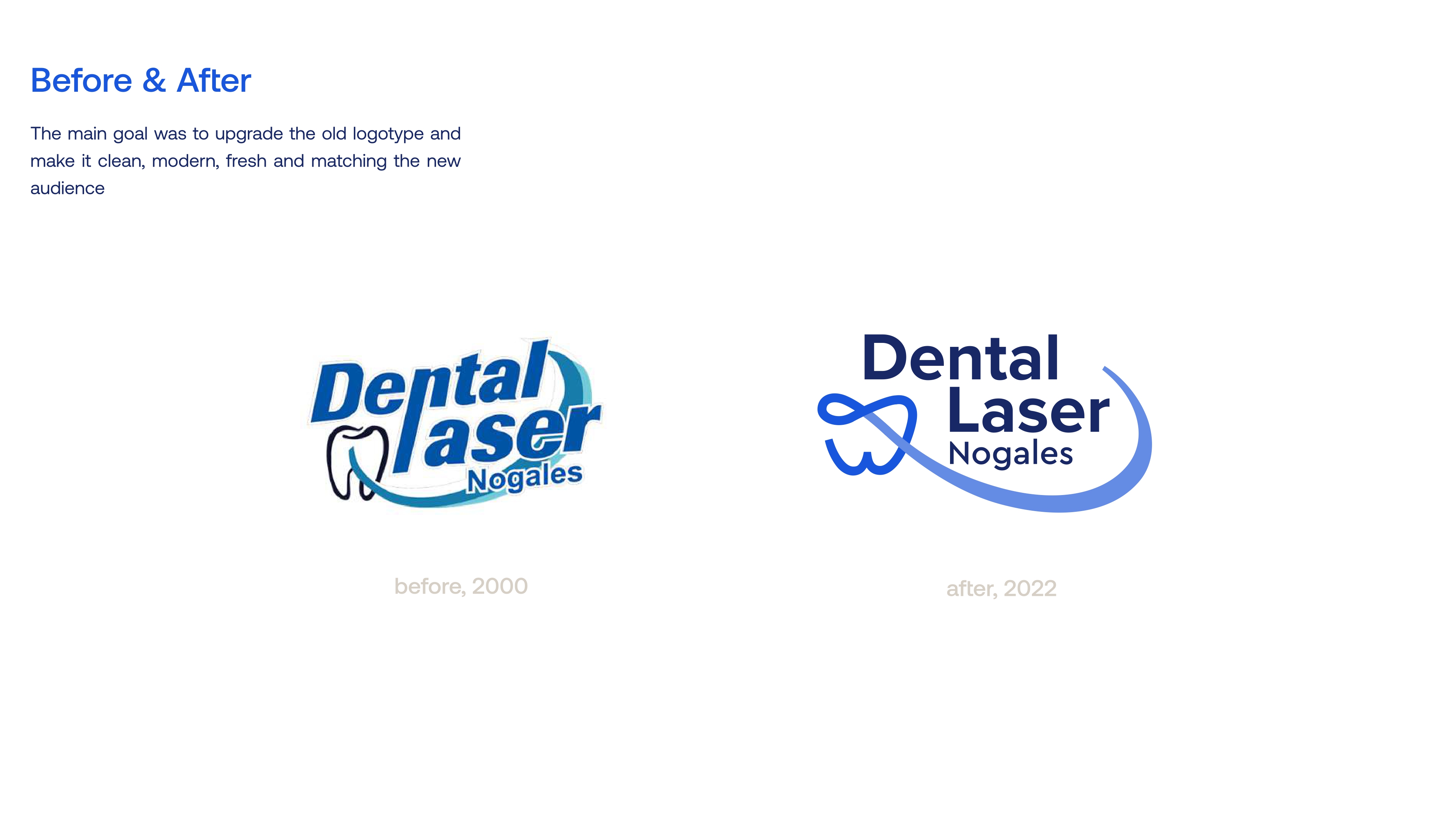 Dental Laser Nogales x Glekel